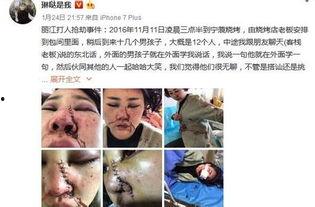 爆料博主毁容事件真相视频,爆料博主遭遇的惊人内幕